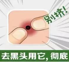 祛黑头的10个问题答案，原来你是这样的黑头