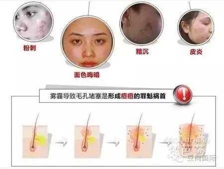 雾霾天怎么护肤呢？