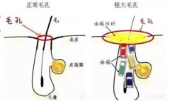 豆尚教你如何解决毛孔粗大 还肌肤白嫩