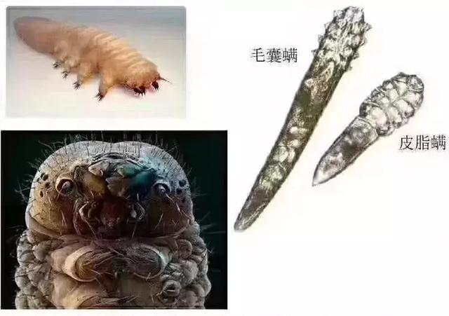 什么是螨虫？脸上被螨虫感染都有危害？