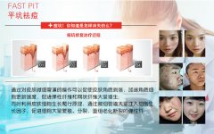豆尚八大服务_8.平坑祛印