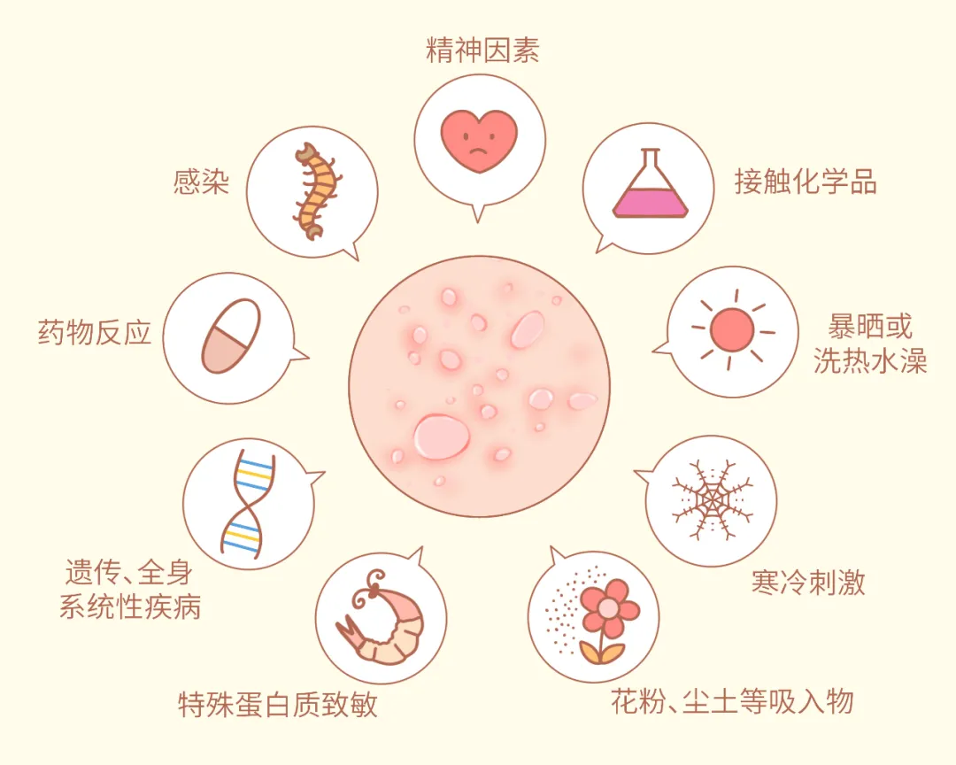 又是一年的过敏高发季，你将如何应对？